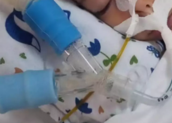 BEBÊ DECLARADO MORTO VOLTA À VIDA APÓS ORAÇÃO DA AVÓ: ‘MILAGRE’