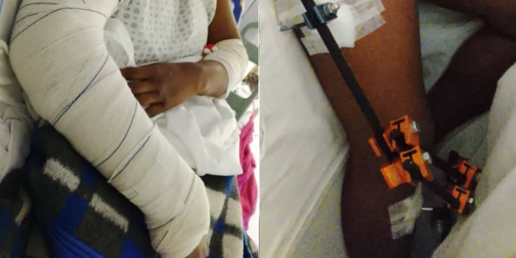 MULHER FICA FERIDA APÓS CONFUSÃO E AGRESSÃO COM BARRA DE FERRO EM AVARÉ